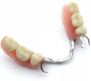 Denture, Crown, Bridge, False Teeth